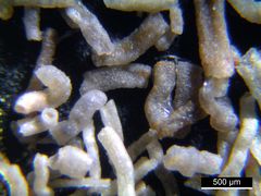 Foraminiferen aus der Kreidezeit - Unteres Turonium