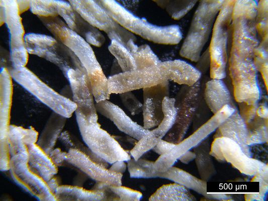 Foraminiferen aus der Kreidezeit - Unteres Turonium