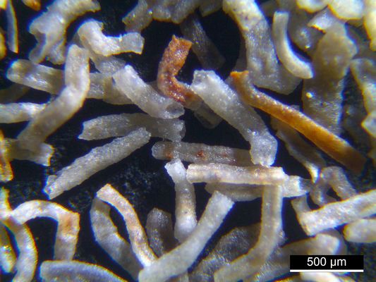 Foraminiferen aus der Kreidezeit - Unteres Turonium