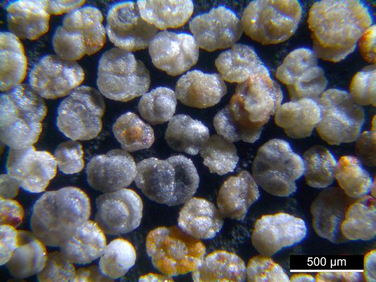 Foraminiferen aus der Kreidezeit - Unteres Turonium