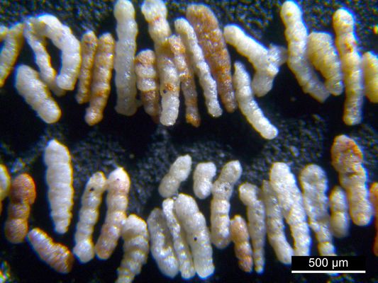 Foraminiferen aus der Kreidezeit - Unteres Turonium