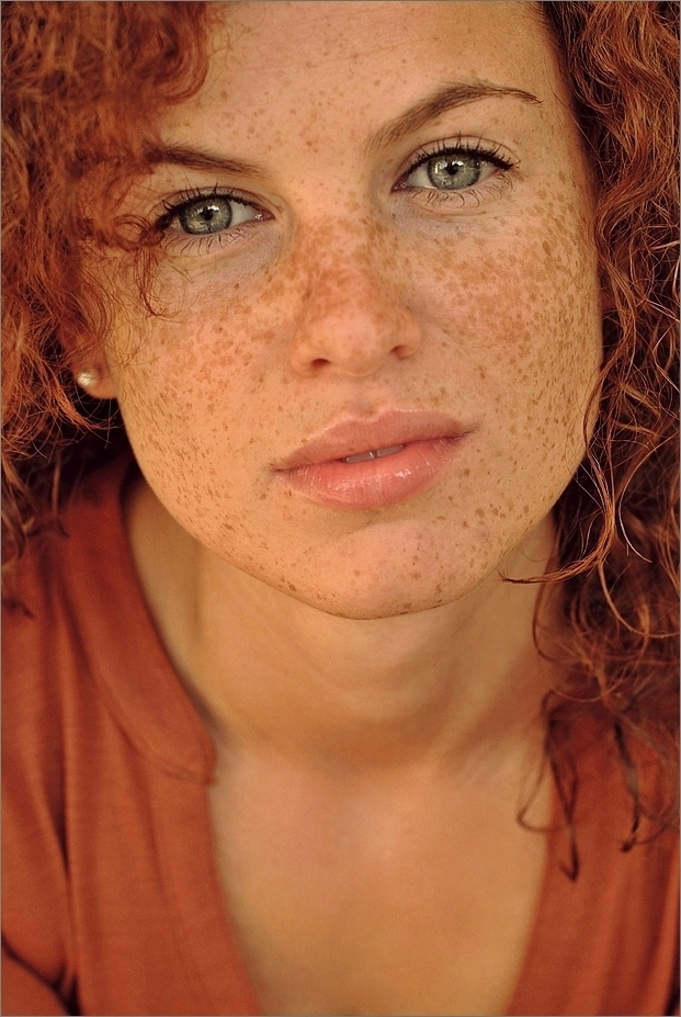 *freckles*