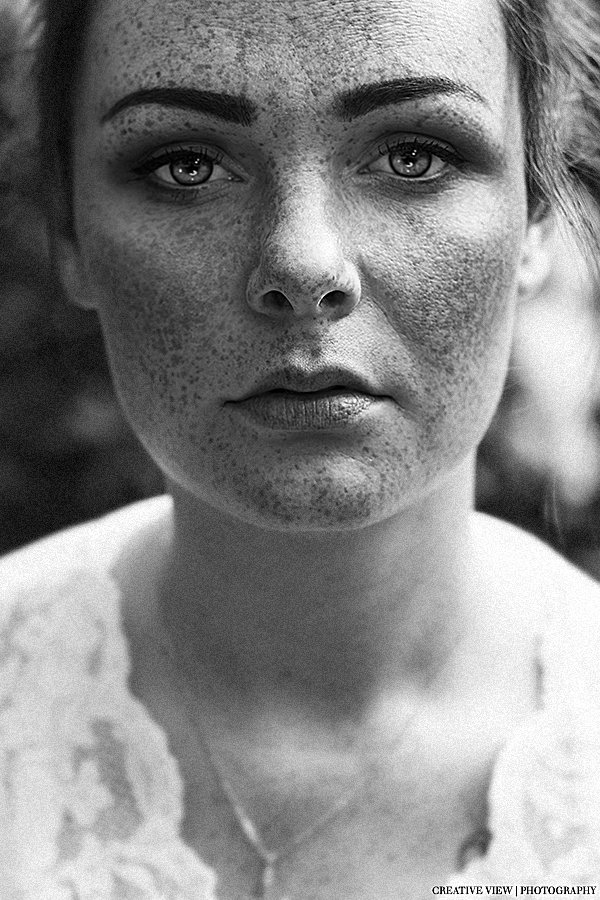 FRECKLES