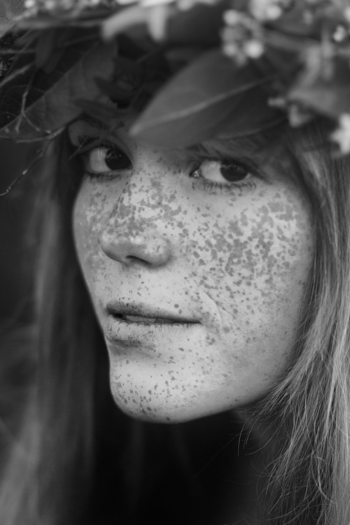 Freckles