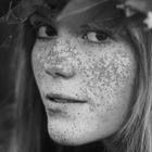 Freckles