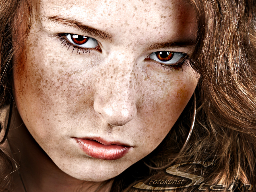 ... freckles ...