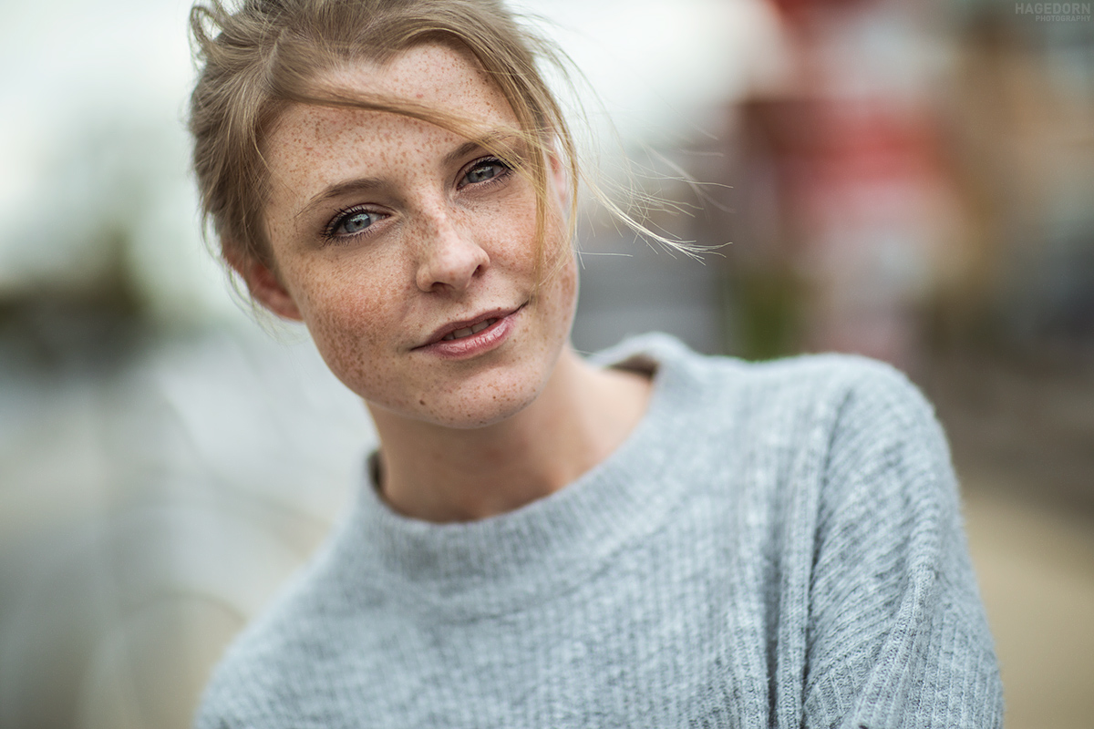 Freckles