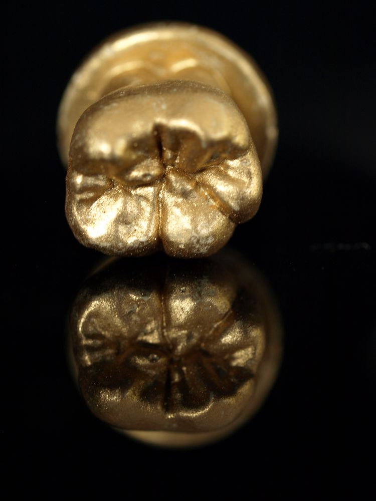 Goldzahn Foto & Bild Ästhetik der sichtbarkeit, specials, spezial