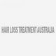 Hair Loss Treatment for Women