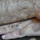 Hairy fingers