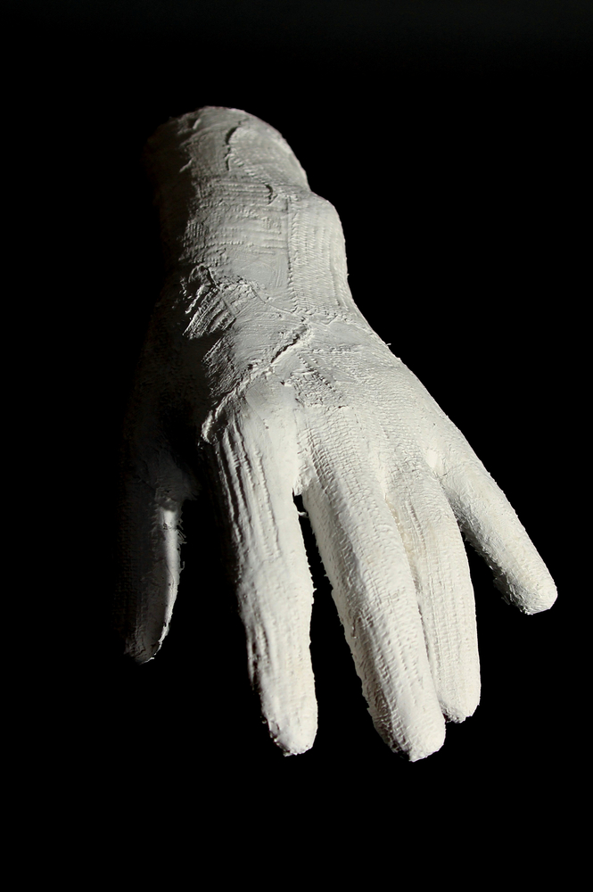 Hand in Gips II