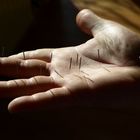 Handakupunktur