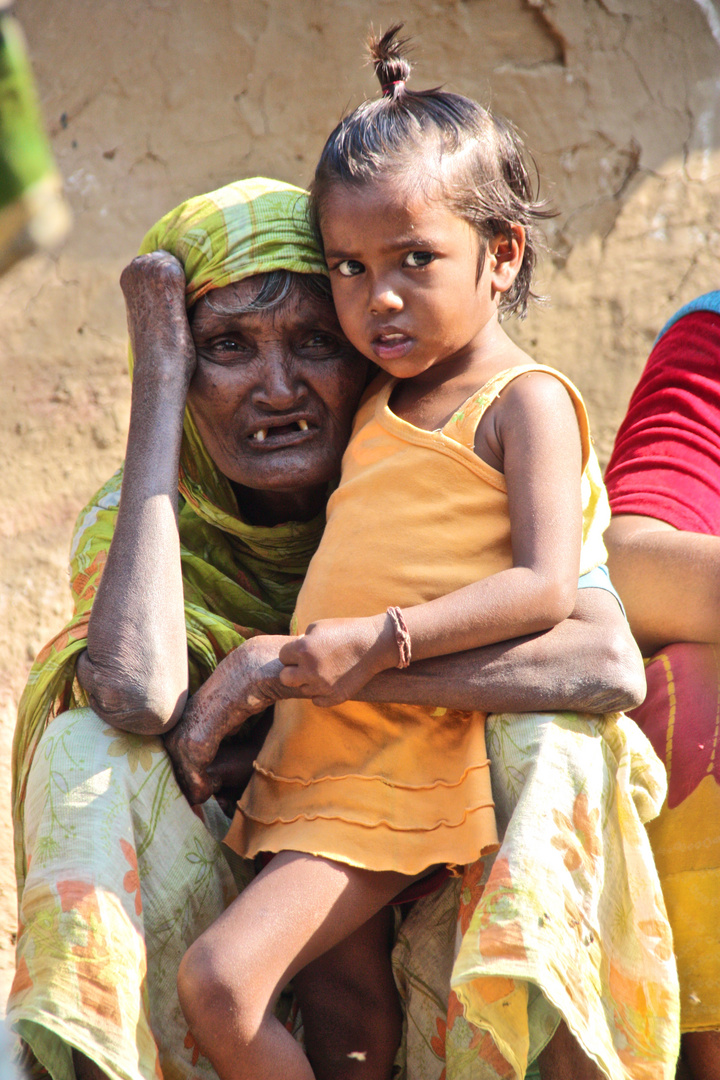 Im Lepra Slum von Patna