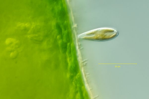 Kieselalge (Gattung Rhoicosphenia) an fädiger Grünalge
