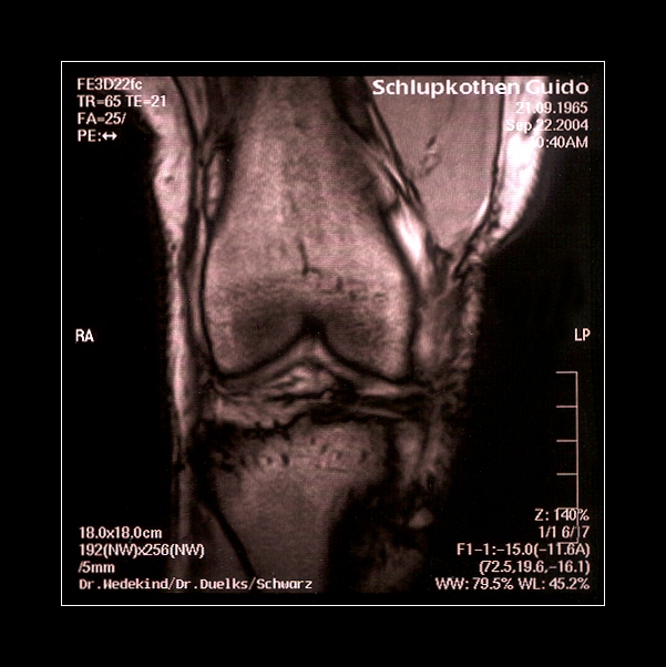 Knie, rechts