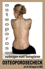 knochenerweichung....vorbeugen statt therapie