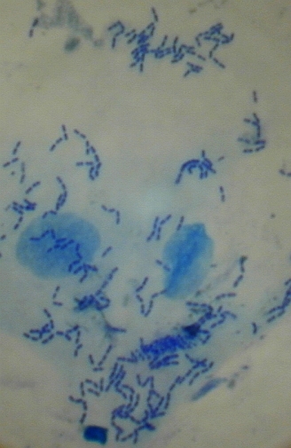 Kokkenbakterien ca. 600x vergrößert (mit Methylenblau gefärbt)