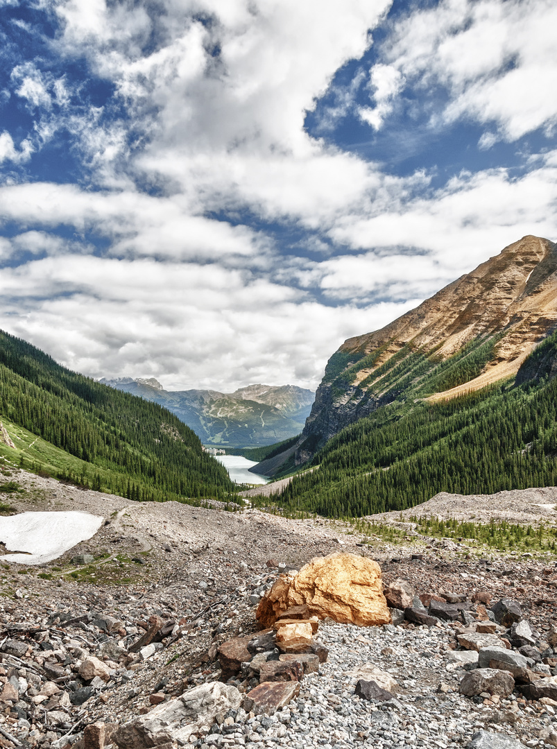 Lake Louise 04