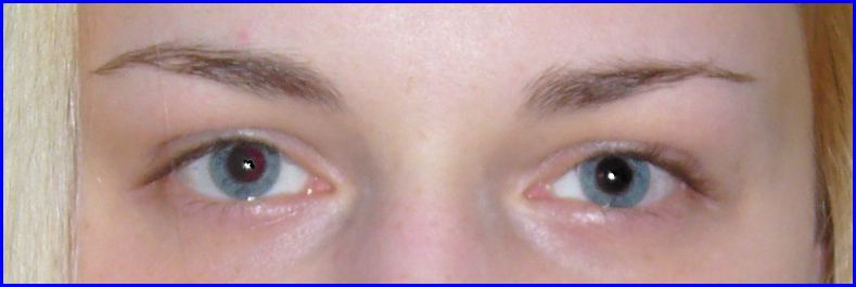leere augen