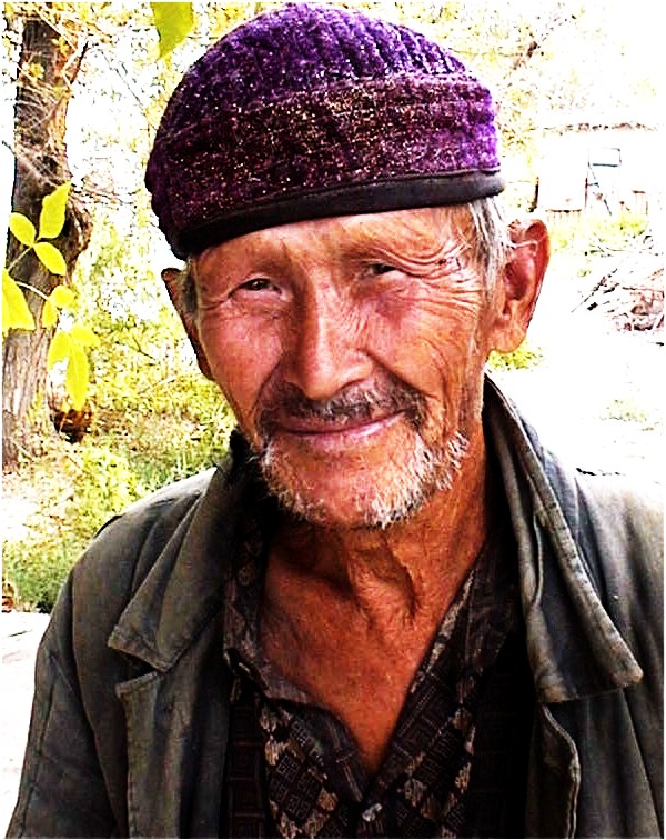 LEPROSARIUM KRANTAU, PATIENT