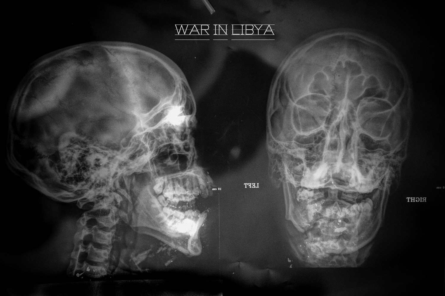 Libya, War - x-rayed skull of a rebel fighter, Benghasi