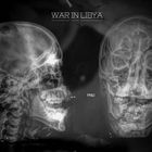 Libya, War - x-rayed skull of a rebel fighter, Benghasi