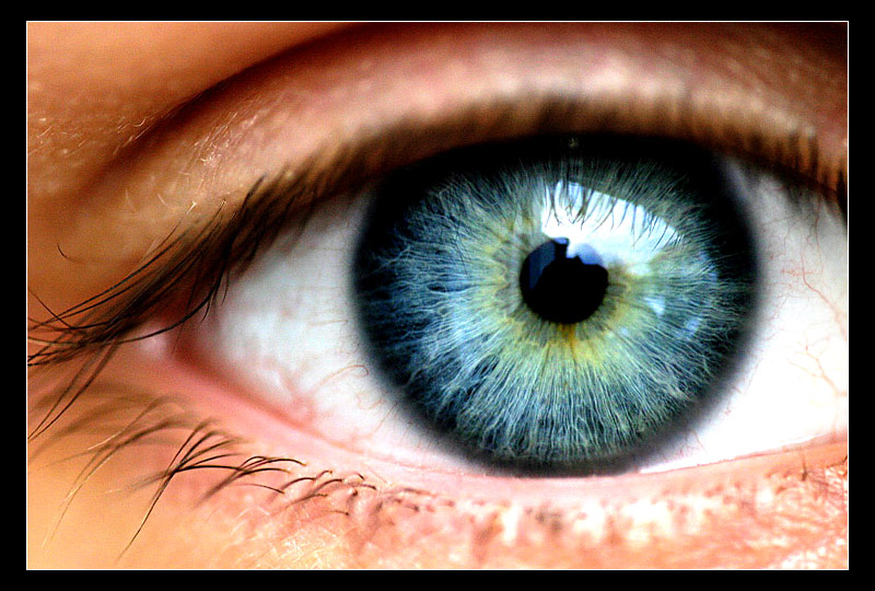 mein blaues Auge?!!! Foto & Bild