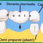 Messina: lasciamo che i parlamentari si facciano il ponte.