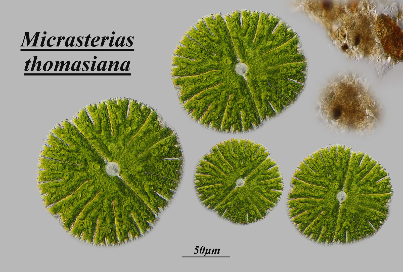 Micrasterias thomasiana 