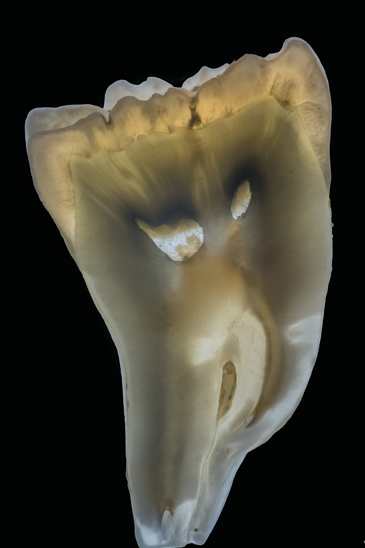 Molar