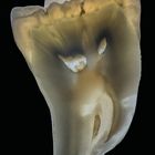 Molar