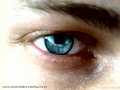 ( my ) Blue Eye