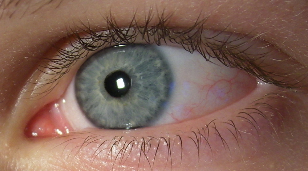 my eye