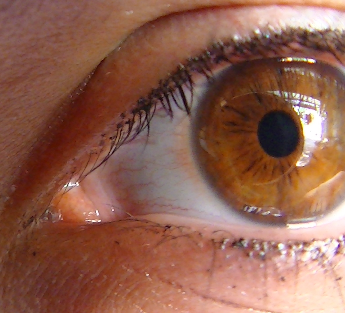 My eye