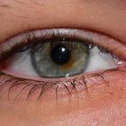 My Eye 