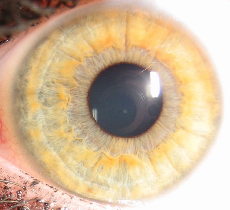 My eye.