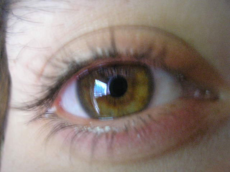 my eye