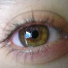 my eye