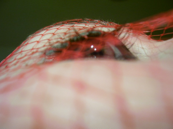 net on my eye