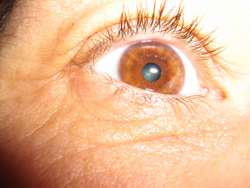 Oeil