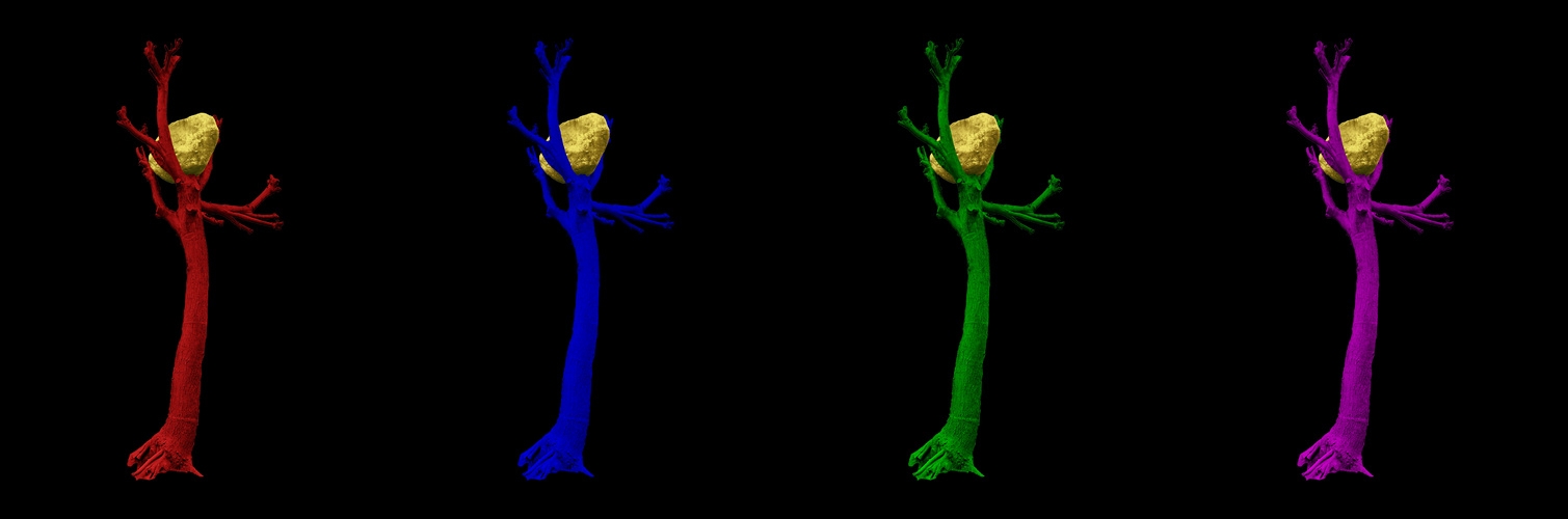 Penonebaum Kassel