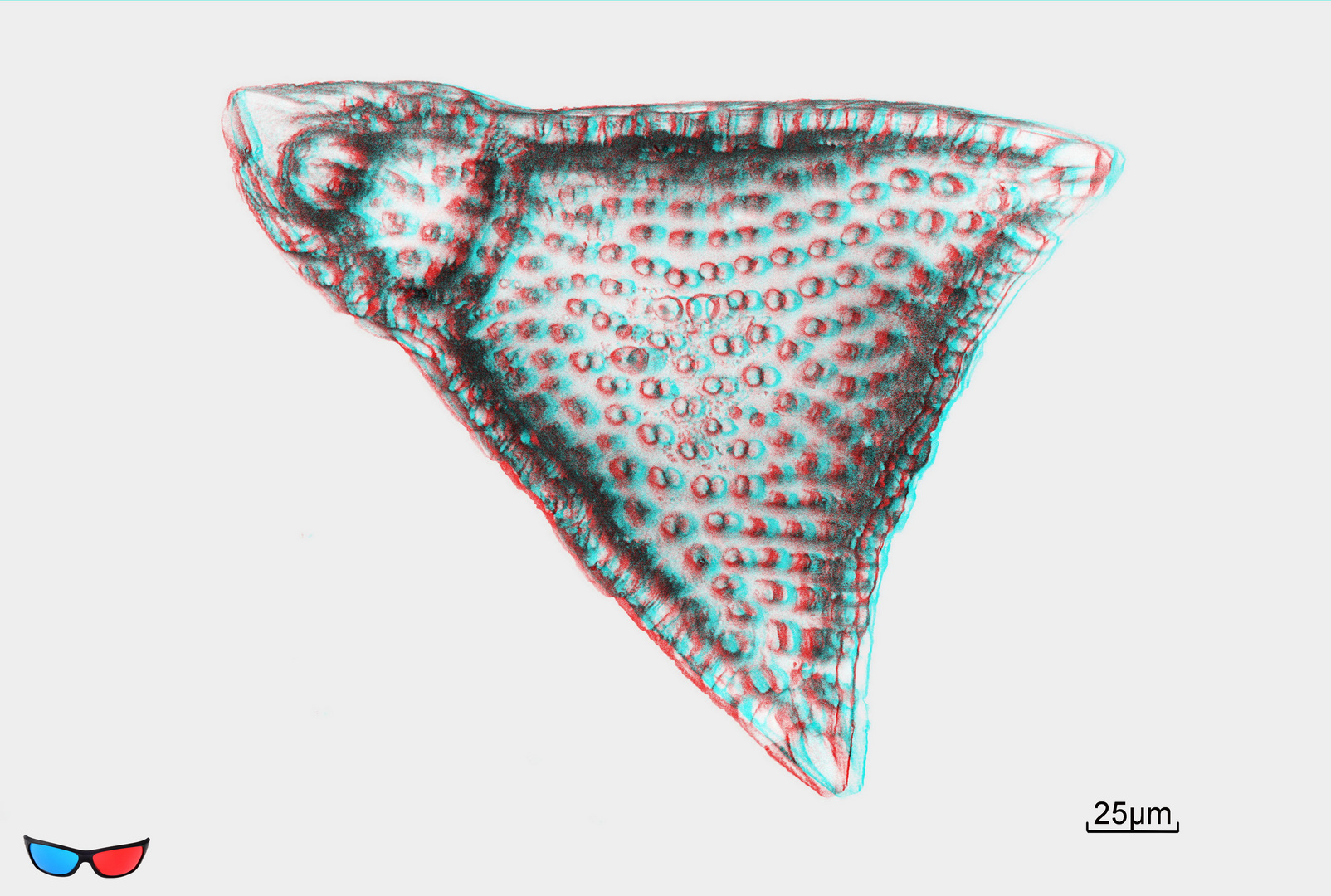 Radiolarie Lithochytris pyramidalis (Ehrenberg)