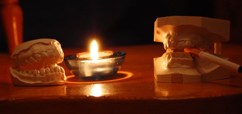 Romantisches Candlelight