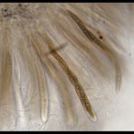 Schläuche und Sporen von Leptosphaeria acuta