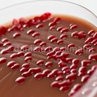 Serratia marcescens