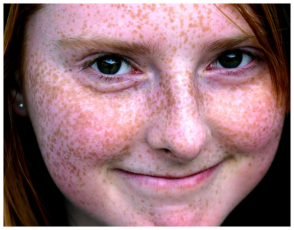 Sommersprossen Foto & Bild kinder, kinder im schulalter, menschen