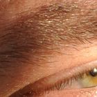 Sonne im Auge ...