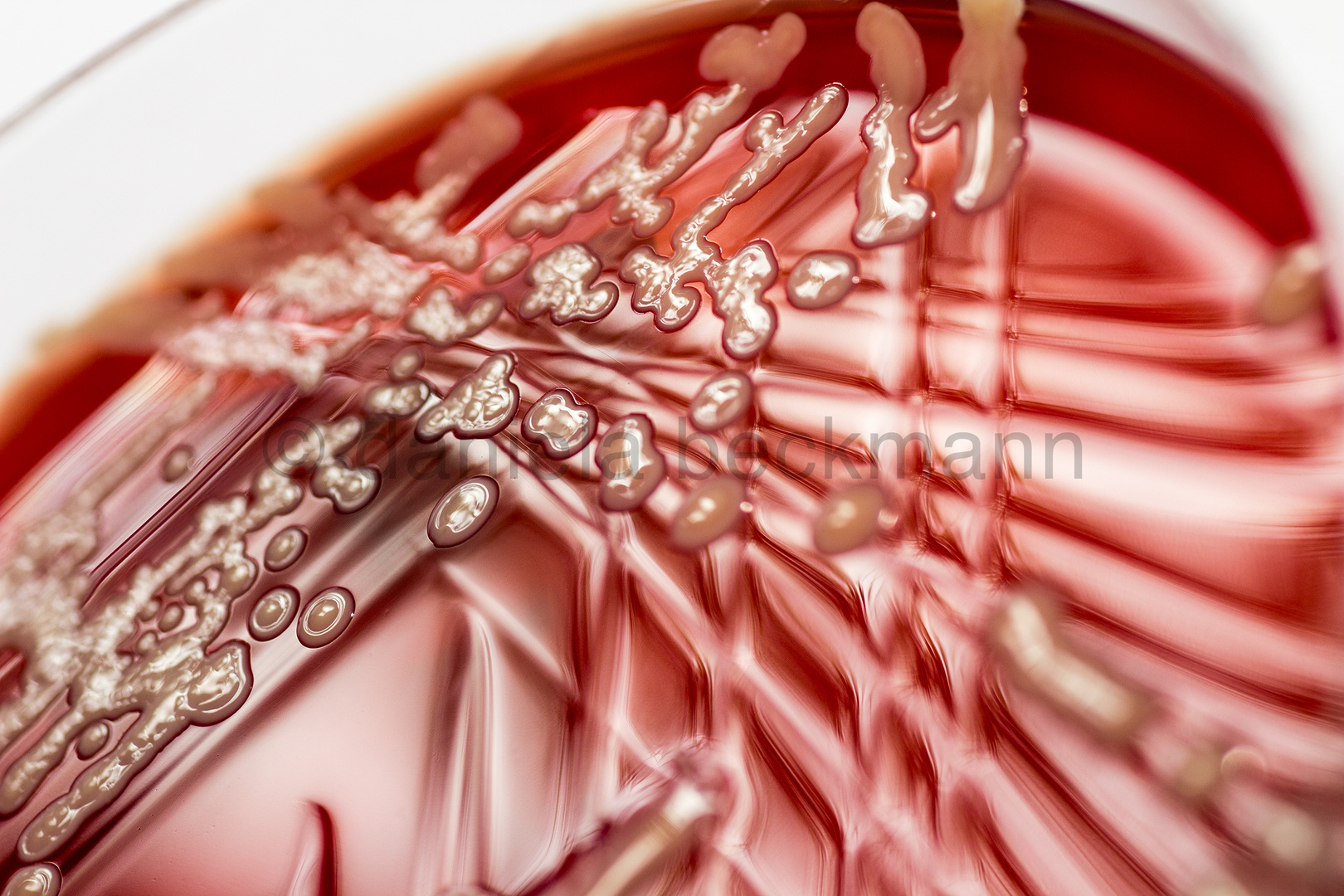 Staphylococcus aureus