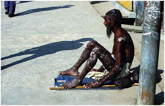 Strassenbettler in Chittagong