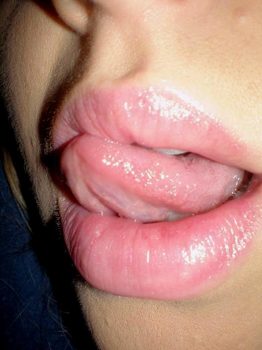 Strawberry Lips